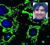 کشف نقش مهم یک پروتئین در عود سرطان با یافته‌های دانشمند ایرانی