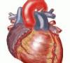 20% کسانی که سکته قلبی کرده اند ، بیماری قلبی نداشته اند