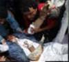 54 کشته در خشونت های دو روز گذشته یمن
