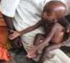 کودکان قحطی زده کنیا در معرض سوء تغذیه قرار دارند