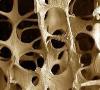 نانوذرات سرامیکی جایگزین استخوان شد/ ترمیم و بهبود سریع استخوان