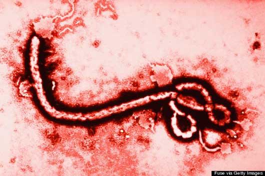 محققان علوم پزشکی در دانشگاه واشنگتن اعلام کردند بررسی آنان نشان می دهد ویروس مرگبار ابولا قادر است دفاع بدن را مختل کند و دستگاه ایمنی را از کار بیاندازد و به این طریق، می تواند از بهبود بیمار، جلوگیری کند.
