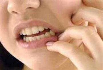 دانشمندان می گویند نوعی میکروب در دهان موسوم به باکتری Fn می تواند خطر ابتلا به سرطان روده بزرگ را افزایش دهد.