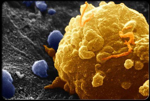 سلول‌های سرطانی به غذاهای مملو از قند مانند نوشابه‌های شیرین، شیرینی و شکلات‌های شیرین علاقه مندند.