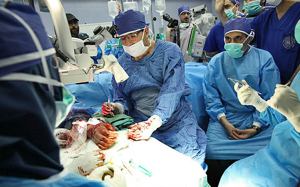 این عمل جراحی پیوند دست از جسد در ایران بعد از ۸.۵ ساعت نفس گیر با موفقیت به پایان رسید.