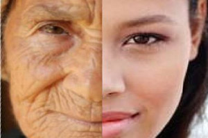 پوست ما انسانها با بالا رفتن سن بطور طبیعی رفته رفته خاصیت ارتجاعی خود را از دست می دهد و به همین دلیل خمیده و چروک می شود.