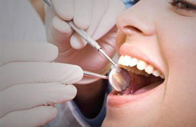 دانشمندان بررسی بر تاثیر جرم دندان بر حملات مغزی و قلبی داشته اند. در این مطلب به شرح نتایج این بررسی می پردازیم.