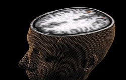 تحقیقات صورت گرفته توسط محققان آمریکایی نشان می دهد، اسکن مغزی می تواند نشانه هایی از بیماری اوتیسم را در اختیار پزشکان قرار داده و زمینه درمان های مداخله یی زودهنگام را فراهم کند.

محققان مرکز تحقیقات MRI دانشگاه آبرن در این مطالعه، اسکن مغزی ۱۵ ن
