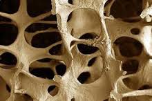 یک محقق ایرانی موفق شد با استفاده از نانو ذرات سرامیکی زمان ترمیم بافت استخوانی آسیب دیده را کاهش دهد.